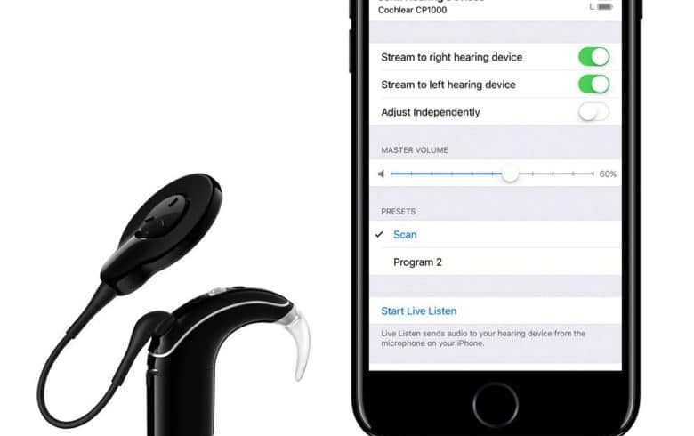Cochlear-780×539