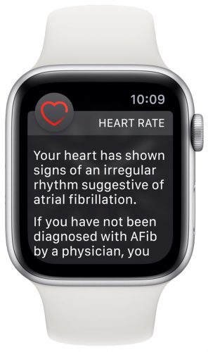 Apple-Watch-Series-4-irregular-Heart-Rate-Notification-296×500
