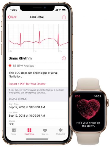 ECG-health-app-irregular-heart-rate-notification-iPhone-Apple-Watch-Series-4-371×500