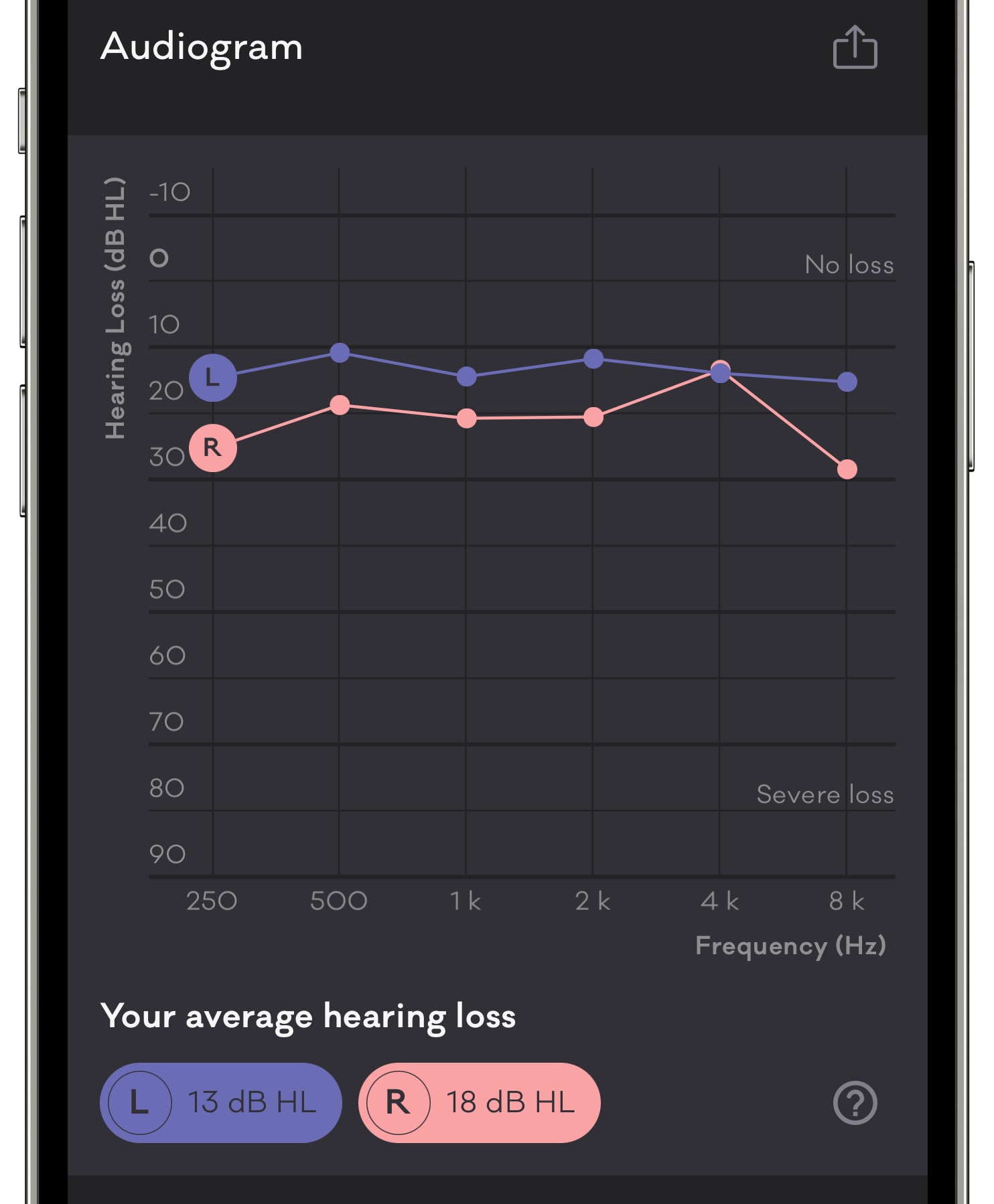 Mimi-Hearing-Test-summary-iphone